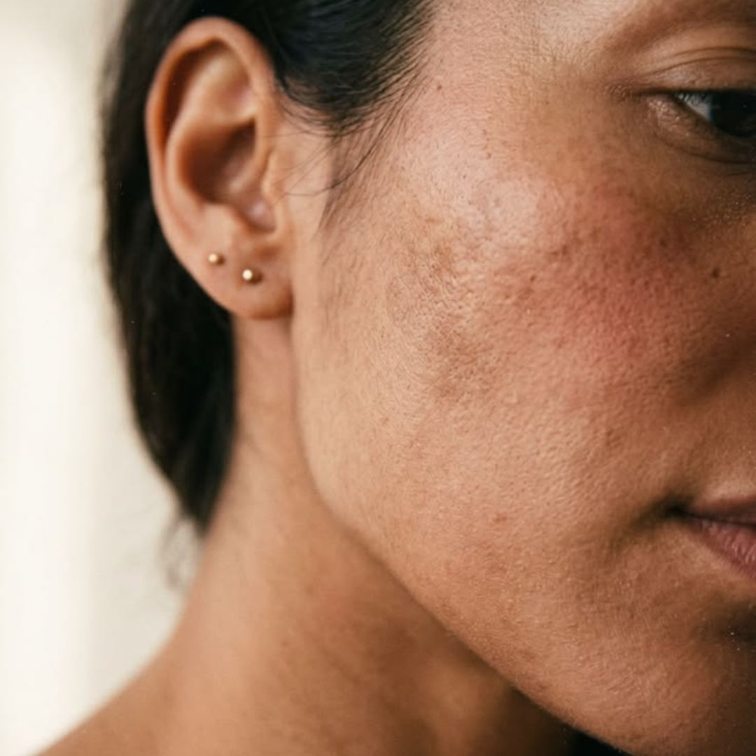 Reduces Dark Spots 